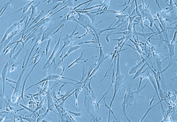 ヒト骨格筋細胞（SkMC）