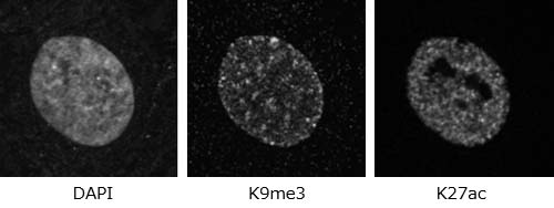 DAPI, K9me3, K27acの蛍光顕微鏡写真