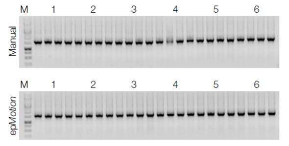 ヒト糞便試料からのDNAを用いた16S rRNA遺伝子の増幅