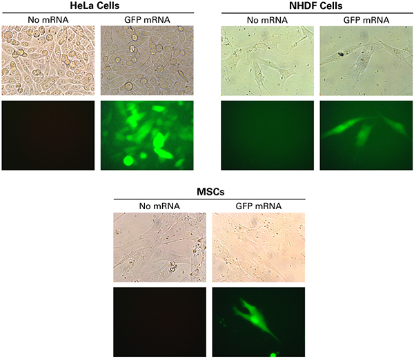 Hela細胞，ヒト皮膚線維芽細胞（NHDF）およびヒト間葉系幹細胞（MSCs）のGFPの発現