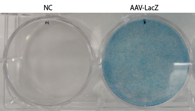 AAV2-LacZ感染細胞のX-gal染色結果