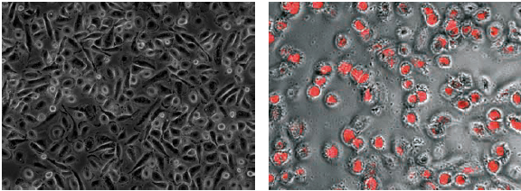 ヒト単核球由来M1マクロファージの細胞形態（左）とM2マクロファージの食作用（右）