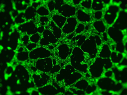 ヒトiPS細胞由来血管内皮細胞を用いたチューブ形成結果