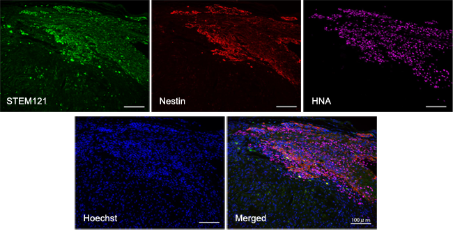 図. ヒトiPS細胞由来の神経幹細胞を移植したマウスの脊髄の免疫組織化学像