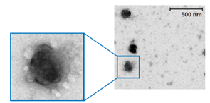 透過型電子顕微鏡の画像