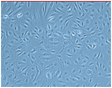 ヒト皮膚微小血管内皮細胞（HDMEC）