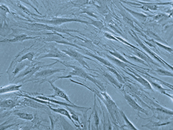 ヒト骨芽細胞（HOB）