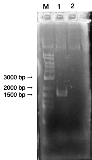 Bacteroides thetaiotaomicron BT0455遺伝子のクローニング