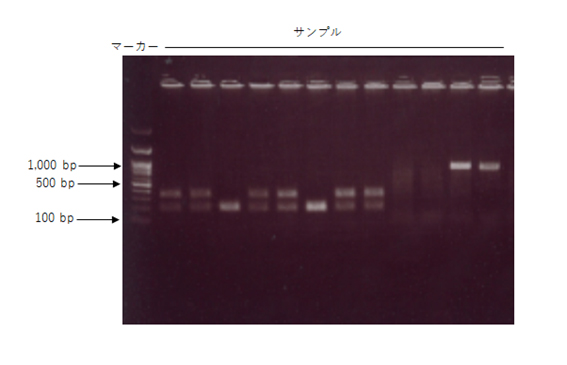 Ex Premierを使用して同一PCR条件での様々なサンプルのジェノタイピング