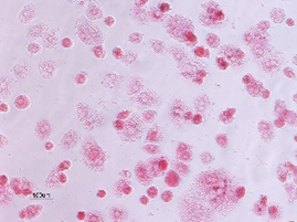 ヒト初代肝細胞