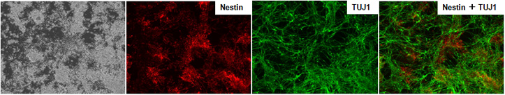 抗Nestin抗体 （神経前駆細胞マーカー）と抗TUJ1抗体（ニューロンマーカー）による免疫染色結果