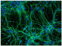 NDiff N2を添加した培地にてヒト神経幹（NS）細胞を接着単層培養
