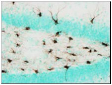 マウス脳の海馬に移植したヒト神経幹細胞の移行と分化を検出した例