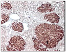 マウス肝臓に移植したヒト肝移植細胞をSTEM121抗体で検出した例