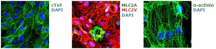 MiraCell Cardiomyocytes (from ChiPSC12) の心筋関連タンパク質の発現解析