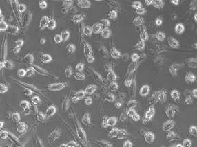 Cellartis Microglia (from ChiPSC12) の細胞像