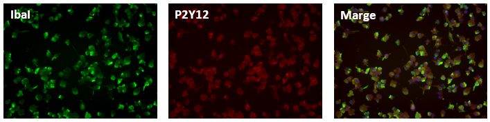 ミクログリアマーカー（Iba1, P2Y12）の免疫染色