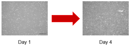 コーティング剤フリーでヒト骨髄由来間葉系幹細胞を培養した場合の細胞観察画像
