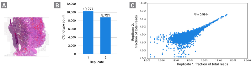 腎細胞がんFFPE組織からの高品質な免疫プロファイリングライブラリー調製